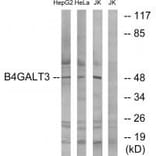 Western blot - B4GALT3 Antibody from Signalway Antibody (34493) - Antibodies.com