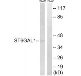 Western blot - ST6GAL1 Antibody from Signalway Antibody (34601) - Antibodies.com