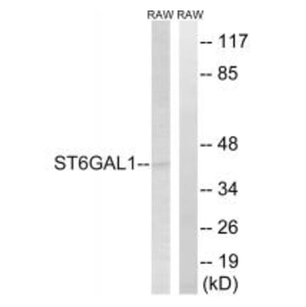 Western blot - ST6GAL1 Antibody from Signalway Antibody (34601) - Antibodies.com