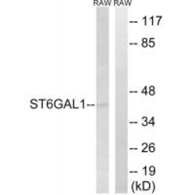 Western blot - ST6GAL1 Antibody from Signalway Antibody (34601) - Antibodies.com