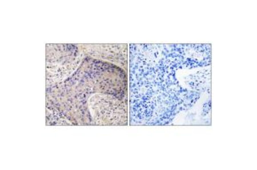 Immunohistochemistry - ST6GAL1 Antibody from Signalway Antibody (34601) - Antibodies.com