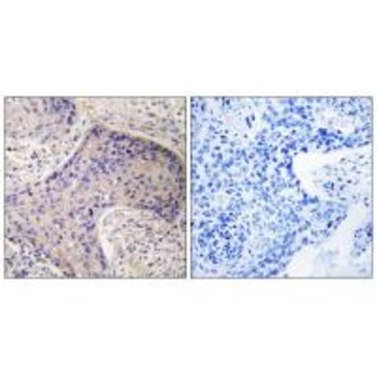 Immunohistochemistry - ST6GAL1 Antibody from Signalway Antibody (34601) - Antibodies.com