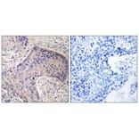 Immunohistochemistry - ST6GAL1 Antibody from Signalway Antibody (34601) - Antibodies.com