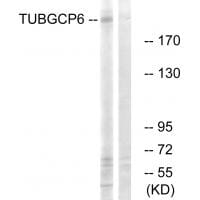 Western blot analysis of extracts from COLO cells, using TUBGCP6 antibody #34698.