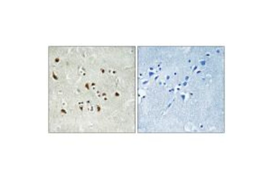 Immunohistochemistry - TUBGCP6 Antibody from Signalway Antibody (34698) - Antibodies.com