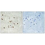 Immunohistochemistry - TUBGCP6 Antibody from Signalway Antibody (34698) - Antibodies.com