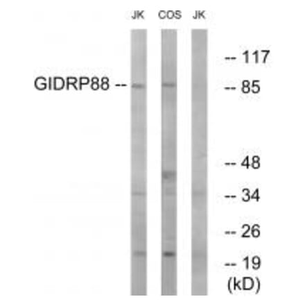 Western blot - GIDRP88 Antibody from Signalway Antibody (34711) - Antibodies.com