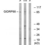 Western blot - GIDRP88 Antibody from Signalway Antibody (34711) - Antibodies.com