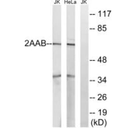 Western blot - PPP2R1B Antibody from Signalway Antibody (35031) - Antibodies.com