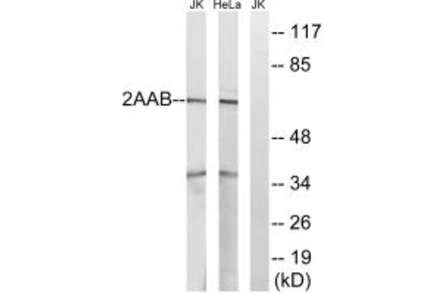 Western blot - PPP2R1B Antibody from Signalway Antibody (35031) - Antibodies.com