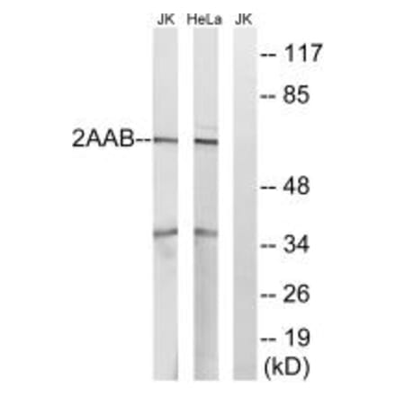 Western blot - PPP2R1B Antibody from Signalway Antibody (35031) - Antibodies.com