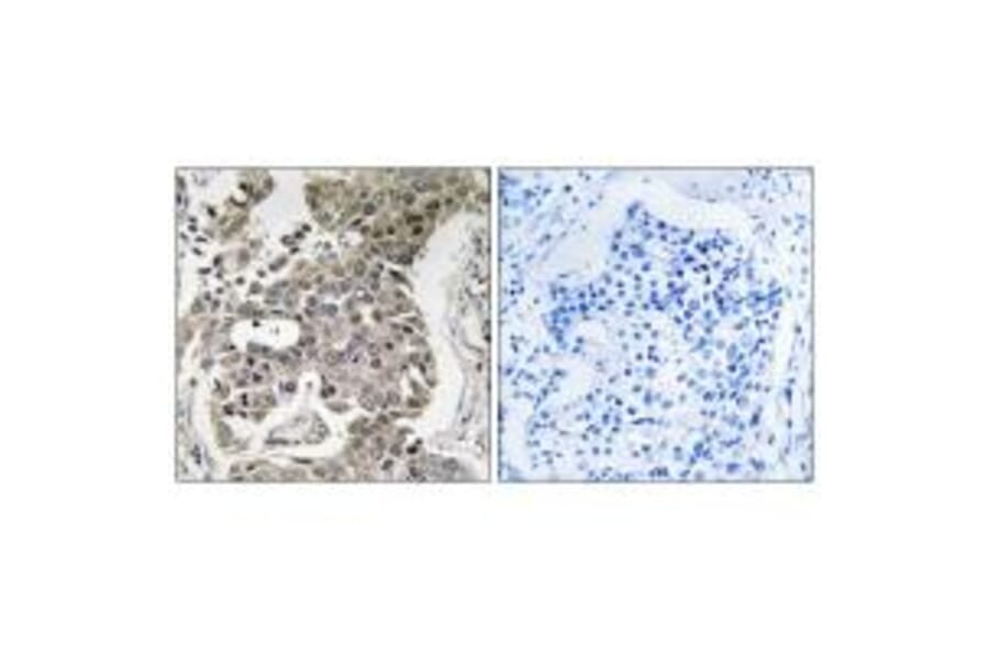 Immunohistochemistry - PPP2R1B Antibody from Signalway Antibody (35031) - Antibodies.com