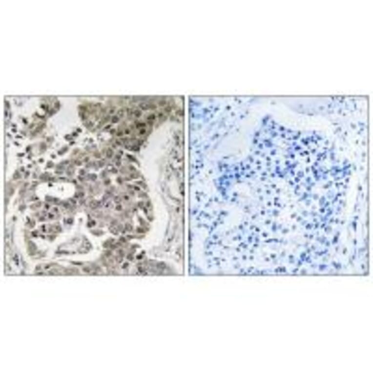 Immunohistochemistry - PPP2R1B Antibody from Signalway Antibody (35031) - Antibodies.com