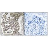 Immunohistochemistry - PPP2R1B Antibody from Signalway Antibody (35031) - Antibodies.com