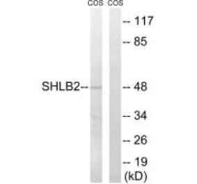 Western blot - SH3GLB2 Antibody from Signalway Antibody (35045) - Antibodies.com