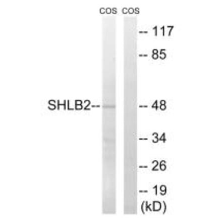 Western blot - SH3GLB2 Antibody from Signalway Antibody (35045) - Antibodies.com