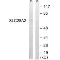 Western blot analysis of extracts from Jurkat cells, using SLC28A2 antibody #35061.