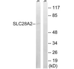 Western blot - SLC28A2 Antibody from Signalway Antibody (35061) - Antibodies.com