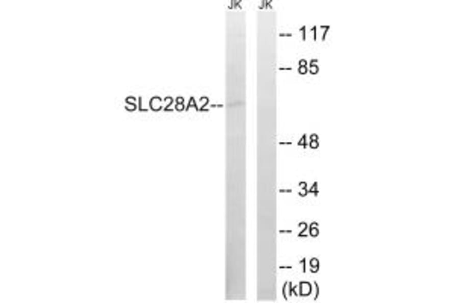 Western blot - SLC28A2 Antibody from Signalway Antibody (35061) - Antibodies.com