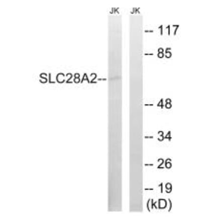 Western blot - SLC28A2 Antibody from Signalway Antibody (35061) - Antibodies.com