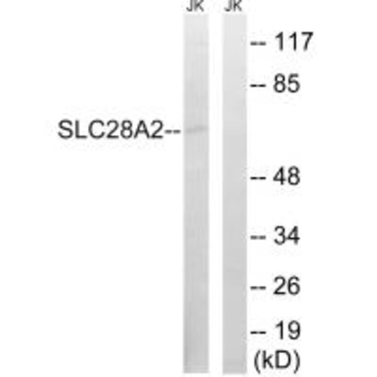 Western blot - SLC28A2 Antibody from Signalway Antibody (35061) - Antibodies.com