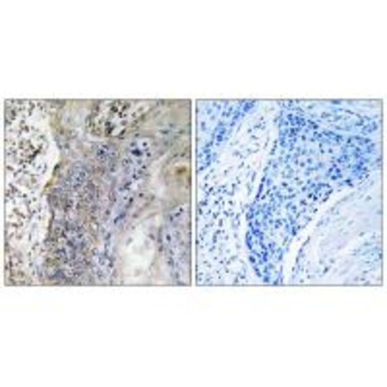 Immunohistochemistry - SLC28A2 Antibody from Signalway Antibody (35061) - Antibodies.com