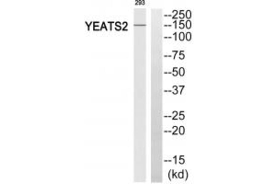 Western blot - YEATS2 Antibody from Signalway Antibody (35149) - Antibodies.com