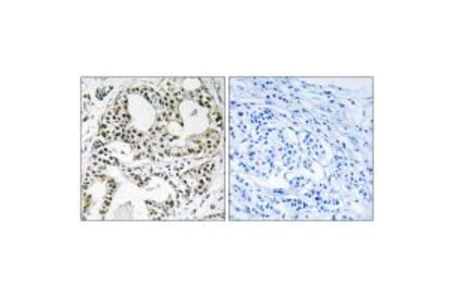 Immunohistochemistry - YEATS2 Antibody from Signalway Antibody (35149) - Antibodies.com