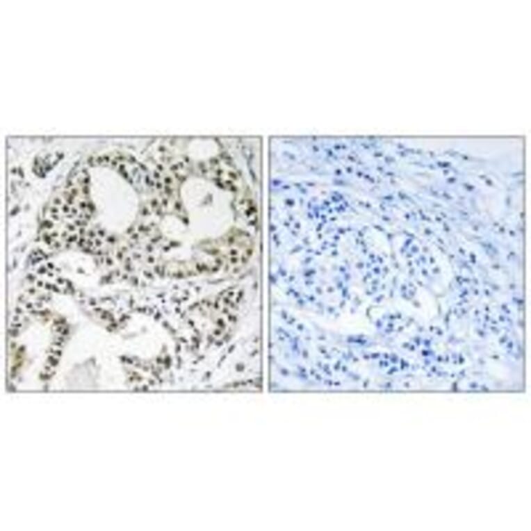 Immunohistochemistry - YEATS2 Antibody from Signalway Antibody (35149) - Antibodies.com