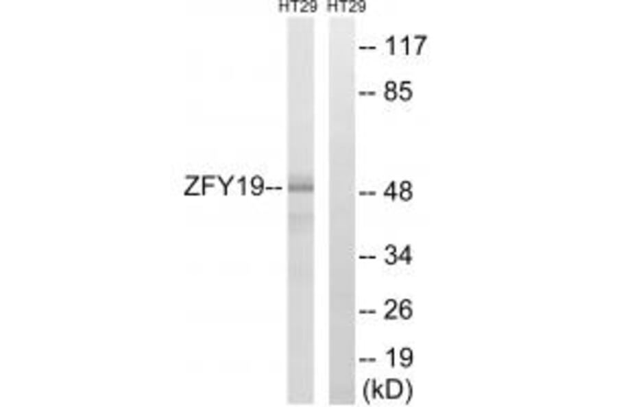 Western blot - ZFYVE19 Antibody from Signalway Antibody (35156) - Antibodies.com