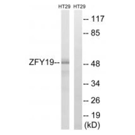 Western blot - ZFYVE19 Antibody from Signalway Antibody (35156) - Antibodies.com
