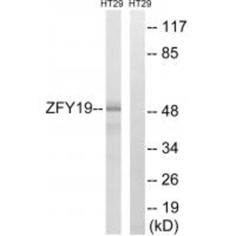 Western blot - ZFYVE19 Antibody from Signalway Antibody (35156) - Antibodies.com