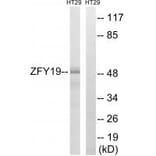 Western blot - ZFYVE19 Antibody from Signalway Antibody (35156) - Antibodies.com