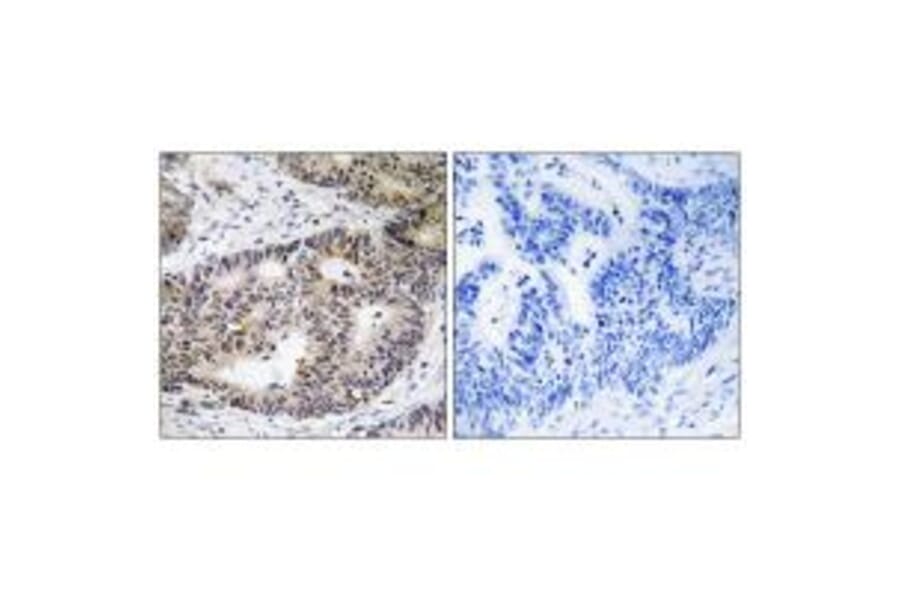 Immunohistochemistry - ZFYVE19 Antibody from Signalway Antibody (35156) - Antibodies.com