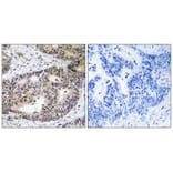 Immunohistochemistry - ZFYVE19 Antibody from Signalway Antibody (35156) - Antibodies.com