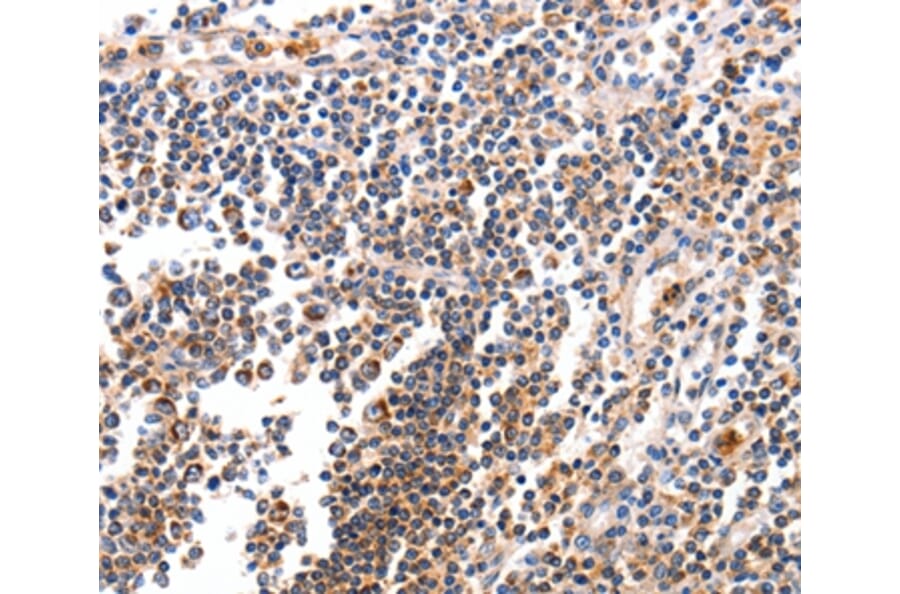 Immunohistochemistry - BCL2L15 Antibody from Signalway Antibody (35595) - Antibodies.com