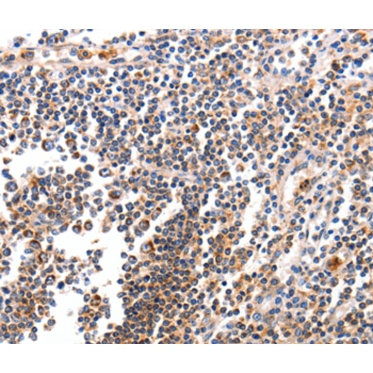 Immunohistochemistry - BCL2L15 Antibody from Signalway Antibody (35595) - Antibodies.com