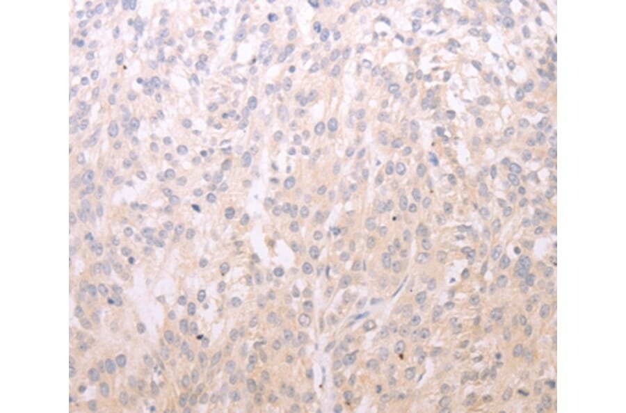 Immunohistochemistry - ADIPOR1 Antibody from Signalway Antibody (35614) - Antibodies.com