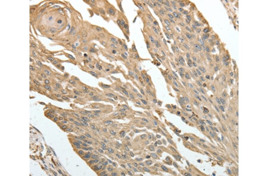 Immunohistochemistry - HSP90B1 Antibody from Signalway Antibody (35762) - Antibodies.com