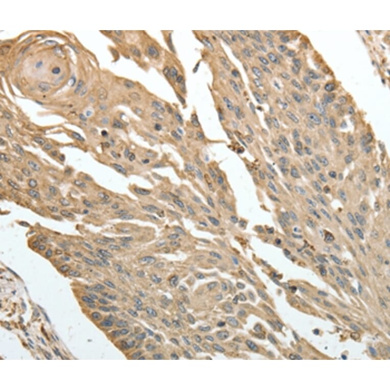 Immunohistochemistry - HSP90B1 Antibody from Signalway Antibody (35762) - Antibodies.com