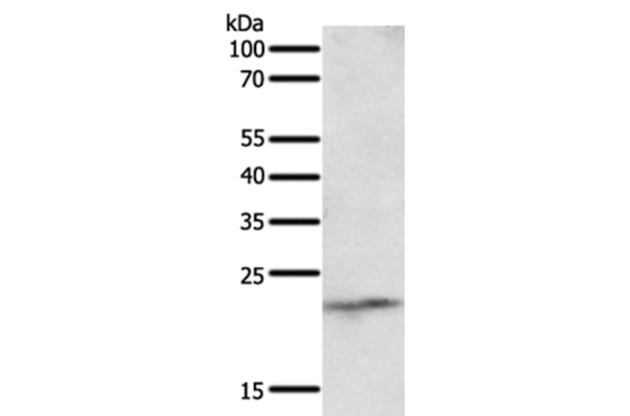 NEUROG3 Antibody from Signalway Antibody (35837) - Antibodies.com
