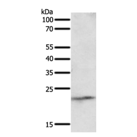 NEUROG3 Antibody from Signalway Antibody (35837) - Antibodies.com