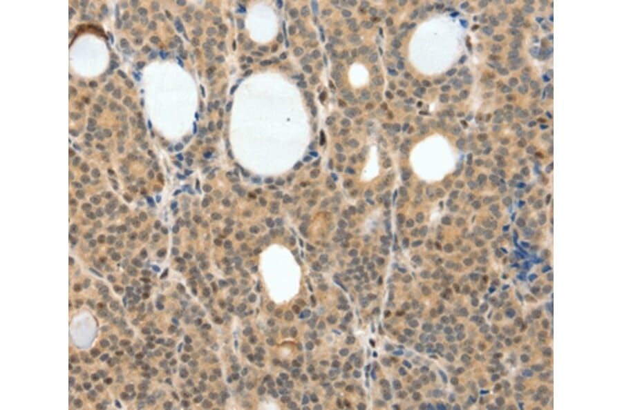 Immunohistochemistry - NEUROG3 Antibody from Signalway Antibody (35837) - Antibodies.com