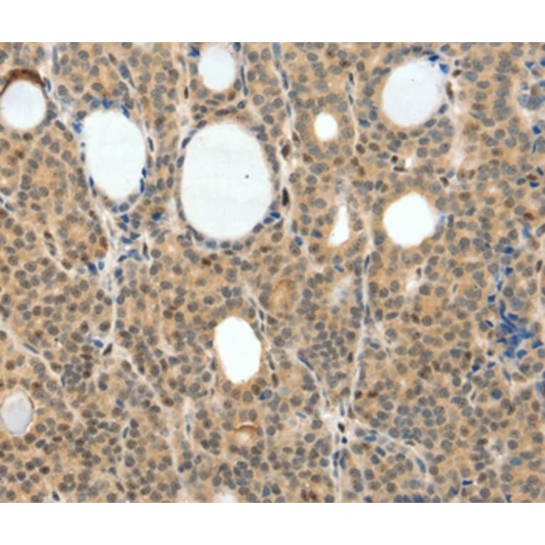 Immunohistochemistry - NEUROG3 Antibody from Signalway Antibody (35837) - Antibodies.com