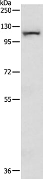 Gel: 8% SDS-PAGE Lysates (from left to right): Mouse lung tissue Amount of lysate: 40ug per lane Primary antibody: 1/200 dilution Secondary antibody dilution: 1/8000 Exposure time: 10 minutes