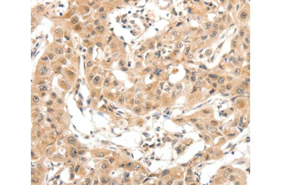 Immunohistochemistry - MAP3K14 Antibody from Signalway Antibody (35838) - Antibodies.com