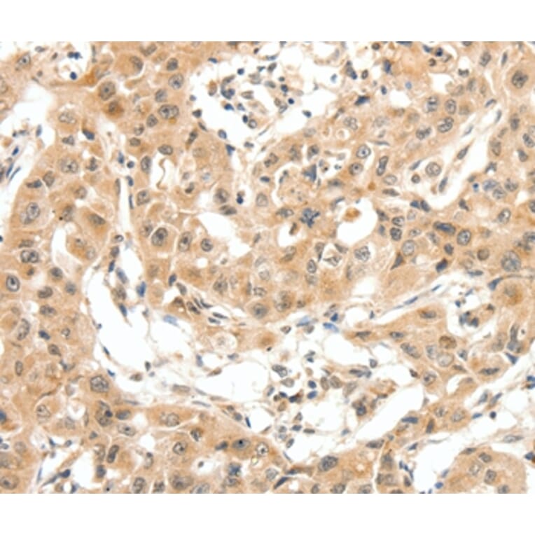 Immunohistochemistry - MAP3K14 Antibody from Signalway Antibody (35838) - Antibodies.com