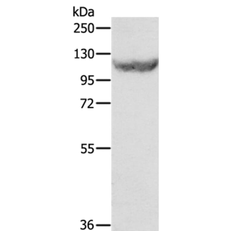 EIF2AK3 Antibody from Signalway Antibody (35876) - Antibodies.com