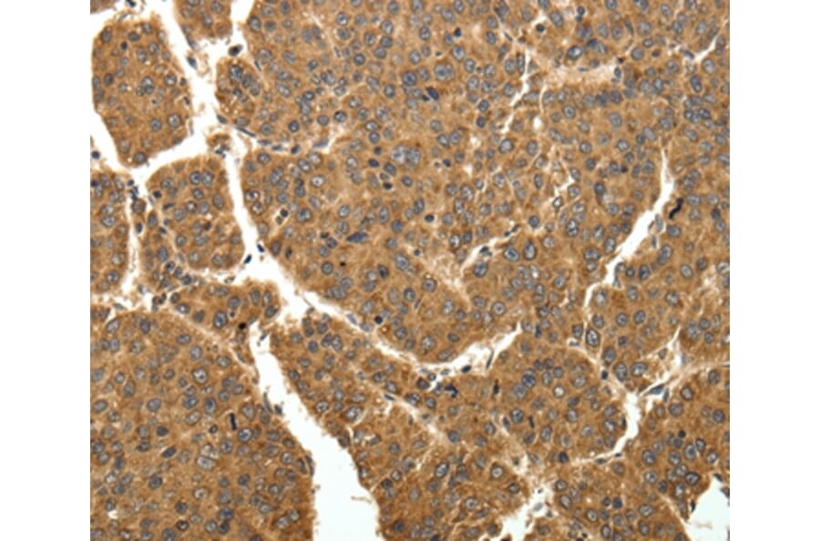 Immunohistochemistry - EIF2AK3 Antibody from Signalway Antibody (35876) - Antibodies.com
