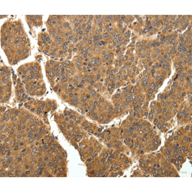 Immunohistochemistry - EIF2AK3 Antibody from Signalway Antibody (35876) - Antibodies.com